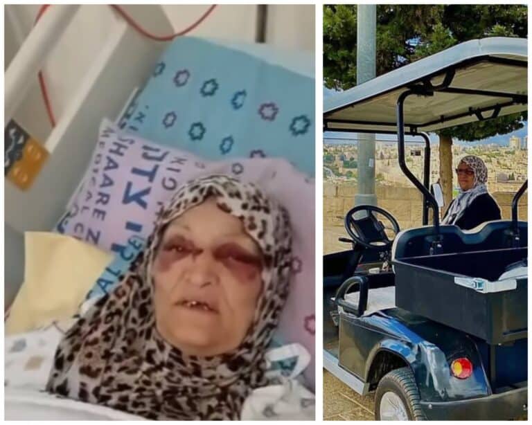 Nafisa Khweis in hospital after electric cart crash in East Jerusalem ar