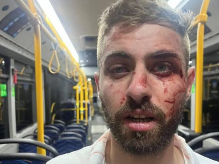 Injured Arab bus driver Ahmad al-Mughrabi in Jerusalem after being assaulted on route 69