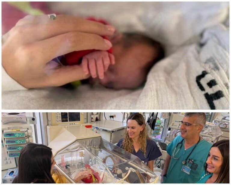 হাদাসা মাউন্ট স্কোপাসে এলাত থেকে আনা নবজাতককে গ্রহণ করছে নবজাতক ইউনিট