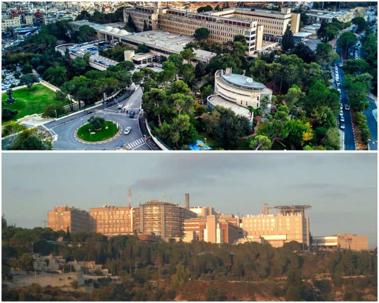 הדסה הר הצופים והדסה עין כרם בירושלים