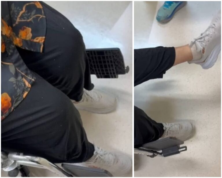 גילה, מטופלת שעברה ניתוח בעמוד השדרה במרכז הרפואי שערי צדק בירושלים, מזיזה בהצלחה את רגלה