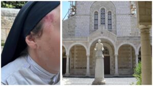 נזירה עם סימני חבלה בפניה לצד מבנה בית הספר הצרפתי למקרא ולארכיאולוגיה בירושלים
