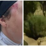 נזירה עם סימני חבלה בפניה לאחר התקיפה בירושלים, לצד תיעוד מזירת האירוע סמוך לקבר דוד