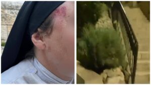 נזירה עם סימני חבלה בפניה לאחר התקיפה בירושלים, לצד תיעוד מזירת האירוע סמוך לקבר דוד